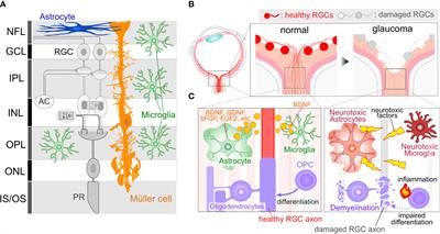Glial cells as a promising therapeutic target of glaucoma: beyond the IOP